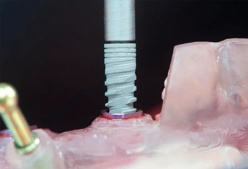 Slide 4